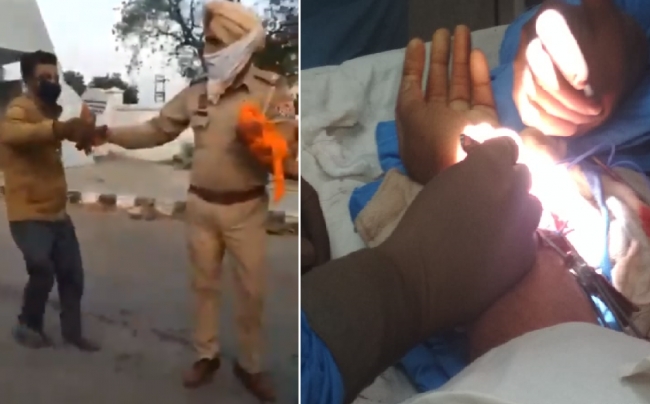 ASI on check post duty wrist got cut in attack : joined by surgery successfully 